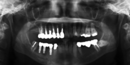 Cyst82O82R.jpg