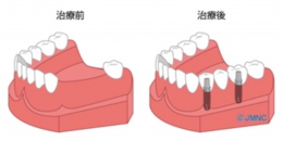 02fukusuhon-sousitsushita-baai-no-chiryo.jpg