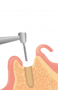 0867001005.png