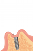 0867001006.png