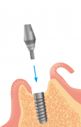 0867001007.png