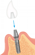 0867001009.png